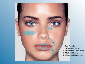 cirurgia plastica porto alegre rs preenchimentos faciais bioplastia botox acido hialuronico pmma